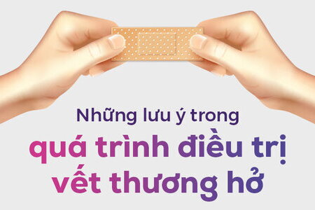 Những lưu ý trong quá trình điều trị vết thương hở mà bạn nên biết