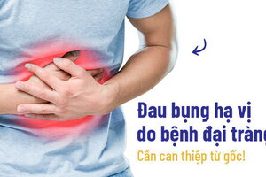 Đau bụng hạ vị do bệnh đại tràng: Cần can thiệp từ gốc!