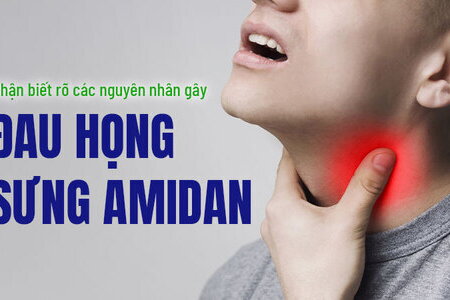 Nhận biết rõ các nguyên nhân gây đau họng sưng amidan