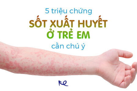 5 triệu chứng sốt xuất huyết ở trẻ em cần chú ý