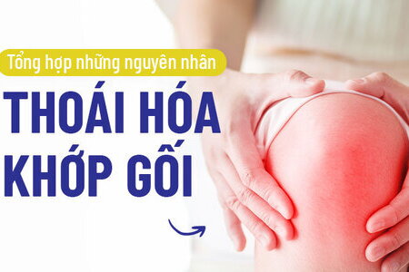 Tổng hợp những nguyên nhân thoái hóa khớp gối