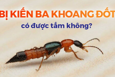 Tư vấn: Bị kiến ba khoang đốt có được tắm không?