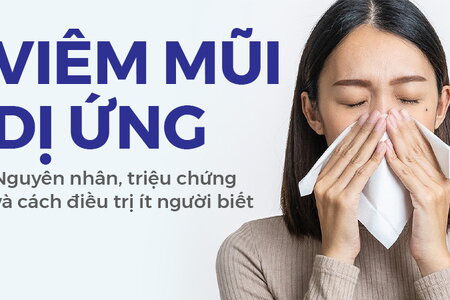 Viêm mũi dị ứng: Nguyên nhân, triệu chứng và cách điều trị