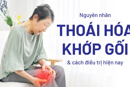 Nguyên nhân thoái hóa khớp gối và cách điều trị hiện nay