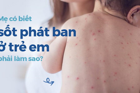 Mẹ có biết sốt phát ban ở trẻ em phải làm sao?