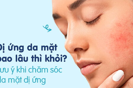 Dị ứng da mặt bao lâu thì khỏi Những lưu ý khi chăm sóc da mặt dị ứng