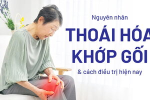 Nguyên nhân thoái hóa khớp gối và cách điều trị hiện nay