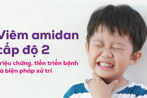 Viêm amidan cấp độ 2: Triệu chứng, tiến triển bệnh và biện pháp