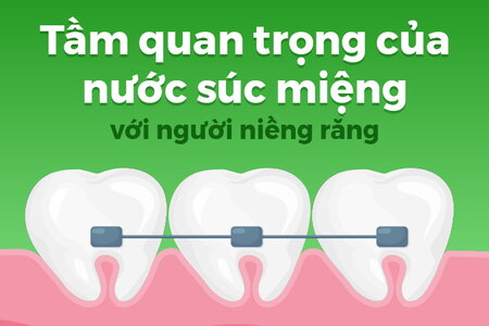 Tầm quan trọng của nước súc miệng với người niềng răng