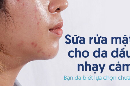 Sữa rửa mặt cho da dầu nhạy cảm: Bạn đã biết lựa chọn chưa?