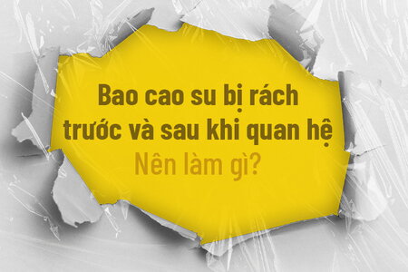 Bao cao su bị rách trước và sau khi quan hệ: Nên làm gì?