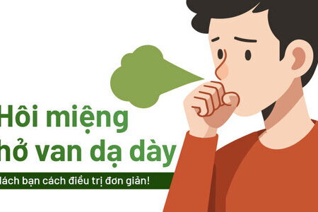 Hôi miệng hở van dạ dày: Mách bạn cách điều trị đơn giản!