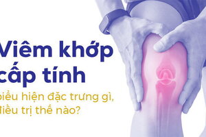 Viêm khớp cấp tính có biểu hiện đặc trưng gì, điều trị thế nào?