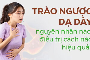 Trào ngược dạ dày nguyên nhân nào, điều trị cách nào hiệu quả?