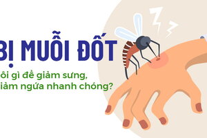 Con bị muỗi đốt bôi gì để giảm sưng, giảm ngứa nhanh chóng?