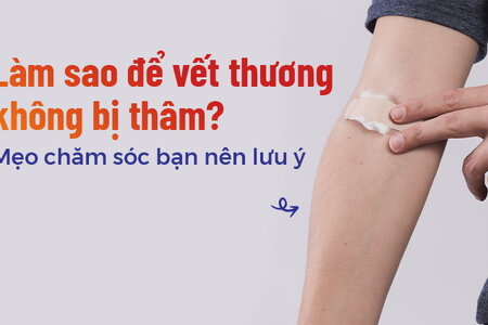 Làm sao để vết thương không bị thâm? Mẹo chăm sóc bạn nên lưu ý