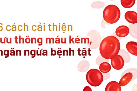 6 cách cải thiện lưu thông máu kém, ngăn ngừa bệnh tật