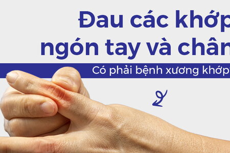 Đau các khớp ngón tay và chân: Có phải bệnh xương khớp?