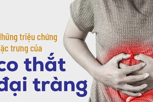 Những triệu chứng đặc trưng của co thắt đại tràng