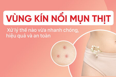 Vùng kín nổi mụn thịt: Hướng dẫn cách xử trí nhanh