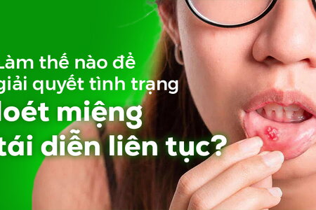 Làm thế nào để giải quyết tình trạng loét miệng tái diễn liên tục?