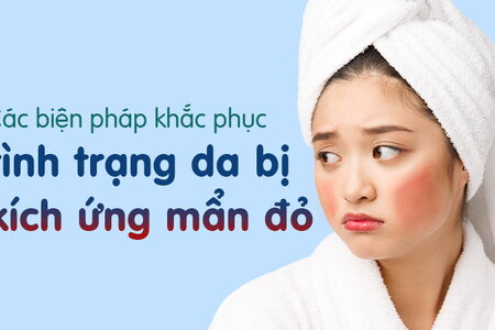 Các biện pháp khắc phục tình trạng da bị kích ứng mẩn đỏ