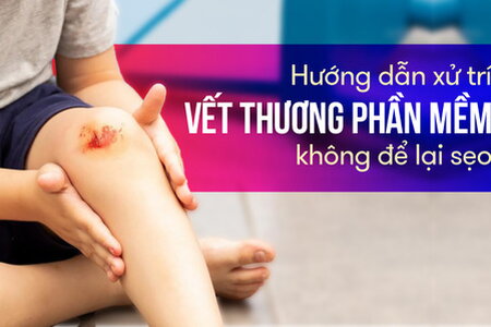 Hướng dẫn xử trí vết thương phần mềm không để lại sẹo