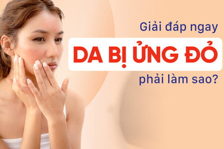 Giải đáp ngay: Da bị ửng đỏ phải làm sao?