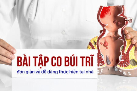 Các bài tập co búi trĩ đơn giản và dễ dàng thực hiện tại nhà