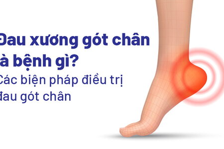 Đau xương gót chân là bệnh gì? Các biện pháp điều trị đau gót chân