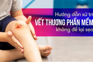 Hướng dẫn xử trí vết thương phần mềm không để lại sẹo