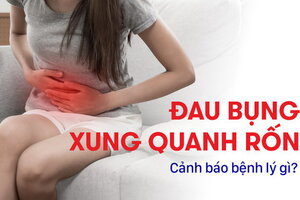 Đau bụng xung quanh rốn: Cảnh báo bệnh lý gì?