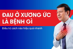 Đau ở xương ức là bệnh gì? Điều trị cách nào hiệu quả nhanh?