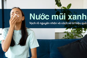 Nước mũi xanh: Vạch rõ nguyên nhân và cách xử trí hiệu quả