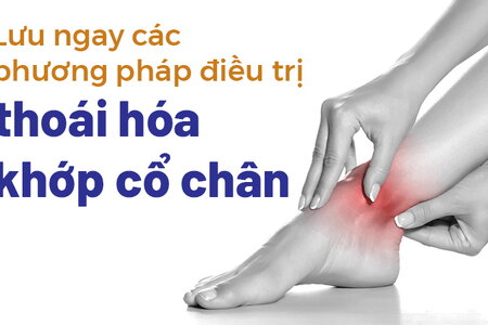 Lưu ngay các phương pháp điều trị thoái hóa khớp cổ chân 