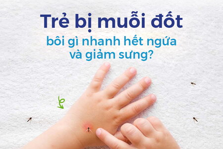 Trẻ bị muỗi đốt bôi gì nhanh hết ngứa và giảm sưng?