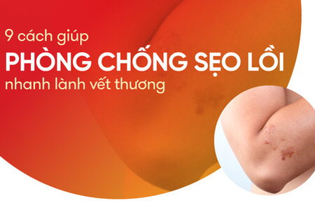 9 cách giúp phòng chống sẹo lồi, nhanh lành vết thương