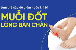 Làm thế nào để giảm ngứa khi bị muỗi đốt lòng bàn chân?