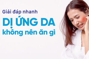 Giải đáp nhanh: Dị ứng da không nên ăn gì?