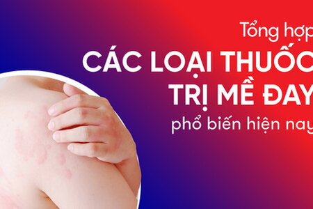 Tổng hợp các loại thuốc trị mề đay phổ biến hiện nay