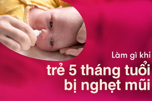 Làm gì khi trẻ 5 tháng tuổi bị nghẹt mũi thường xuyên?