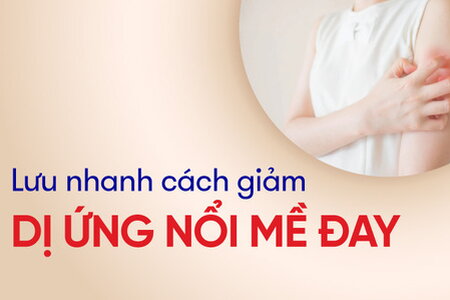 Lưu nhanh cách giảm dị ứng nổi mề đay ngứa ngáy