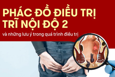 Phác đồ điều trị trĩ nội độ 2 và những lưu ý trong quá trình điều trị