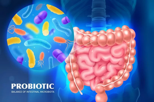 Probiotics là gì? Lợi ích của việc bổ sung lợi khuẩn