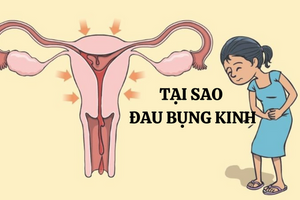 Tại sao đau bụng kinh? Nguyên nhân và cách cải thiện