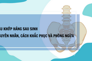 Đau khớp háng sau sinh: Nguyên nhân, cách khắc phục và phòng ngừa