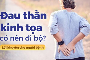 Đau thần kinh tọa có nên đi bộ? Lời khuyên cho người bệnh