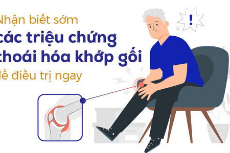 Nhận biết sớm các triệu chứng thoái hóa khớp gối để điều trị ngay