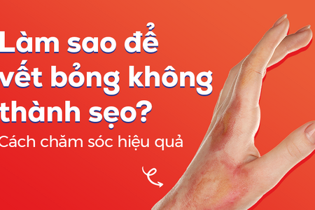 Làm sao để vết bỏng không thành sẹo? Cách chăm sóc hiệu quả