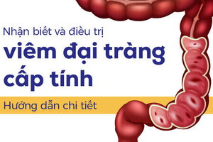 Nhận biết và điều trị viêm đại tràng cấp tính: Hướng dẫn chi tiết